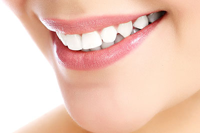 Image displays a close-up of a person s face, focusing on their teeth and smile.