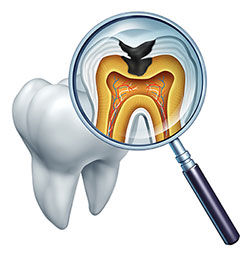 An illustration of a tooth with an open crown, revealing the interior structure and pulp, viewed through a magnifying glass with an X-ray image superimposed on it.