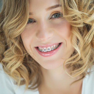 A woman with a radiant smile, showcasing her braces and white teeth, against a soft-focus background.