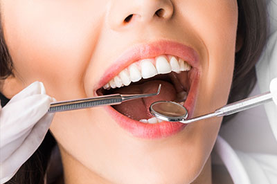 A woman with a toothy grin is sitting in a dental chair, receiving dental care, with a dental hygienist holding a mirror and various dental instruments around her mouth.