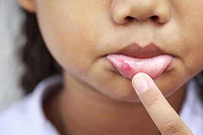 A young child with a finger on their lips, examining a skin blemish.