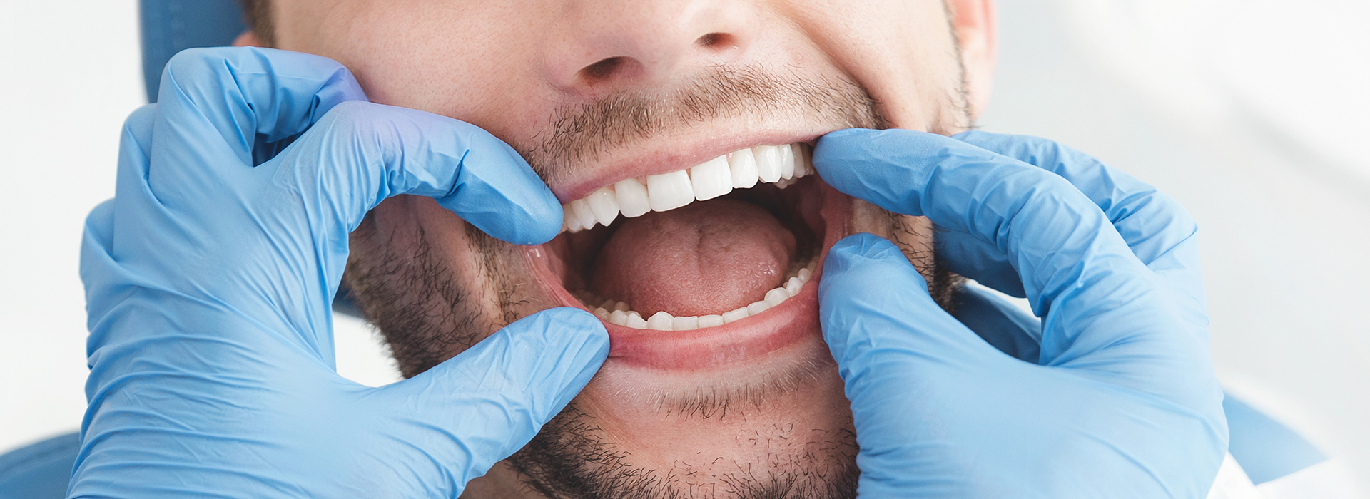 A man in a medical setting, possibly a dental or oral health professional, wearing blue gloves and holding his mouth open with his tongue out.