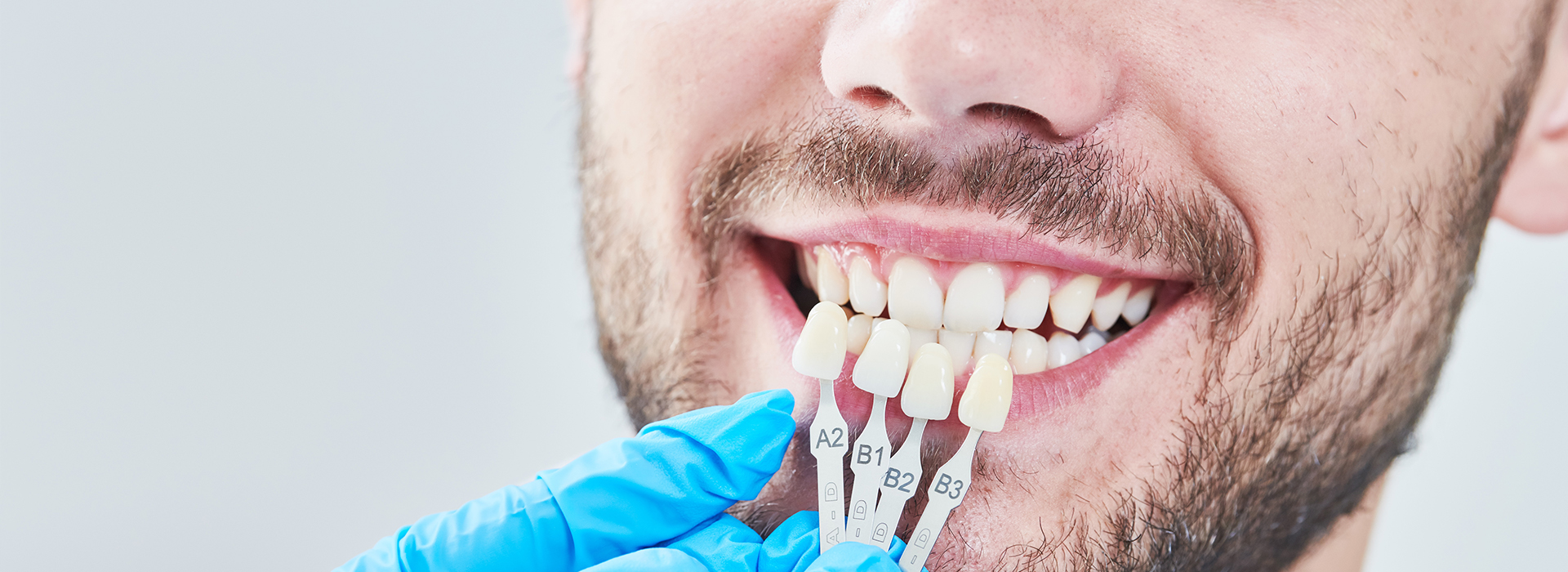 A man with a toothy smile, wearing a blue surgical mask and holding dental implants in his mouth.