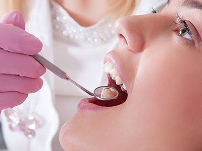 The image shows a dental professional performing a procedure on a patient s mouth, with the patient sitting in a chair and wearing a purple dental bib.