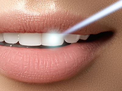 The image shows a close-up of a person s lips with a focus on the teeth, featuring an advertisement for dental care or beauty products.